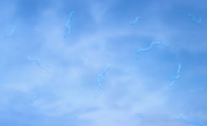 Spots floating in vision field